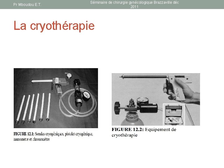 Pr Mboudou E. T. Séminaire de chirurgie gynécologique Brazzaville déc 2011 La cryothérapie 