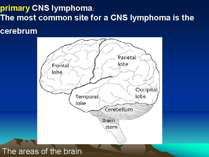 primary CNS lymphoma. : The most common site for a CNS lymphoma is the