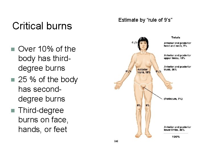 Critical burns n n n Over 10% of the body has thirddegree burns 25