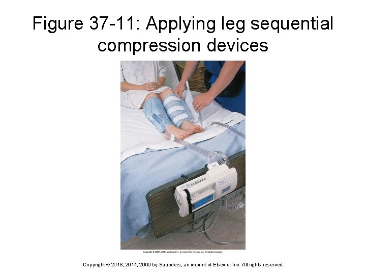 Figure 37 -11: Applying leg sequential compression devices Copyright © 2018, 2014, 2009 by