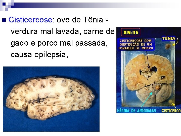 Cisticercose: ovo de Tênia - verdura mal lavada, carne de gado e porco mal