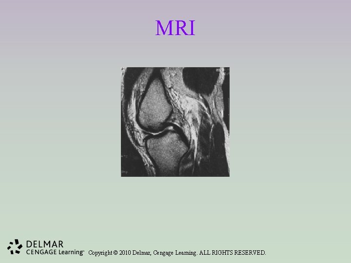 MRI Copyright © 2010 Delmar, Cengage Learning. ALL RIGHTS RESERVED. 