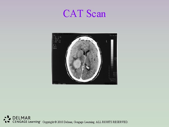 CAT Scan Copyright © 2010 Delmar, Cengage Learning. ALL RIGHTS RESERVED. 