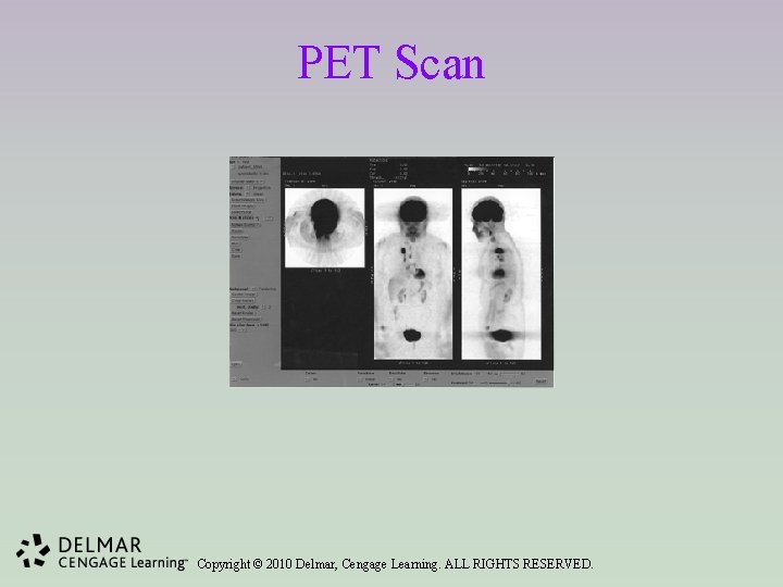 PET Scan Copyright © 2010 Delmar, Cengage Learning. ALL RIGHTS RESERVED. 
