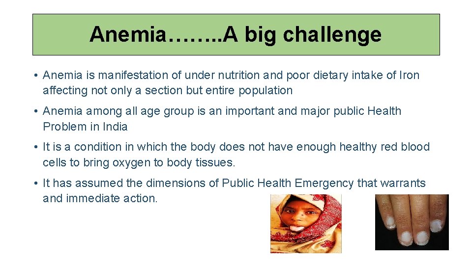 Anemia……. . A big challenge • Anemia is manifestation of under nutrition and poor