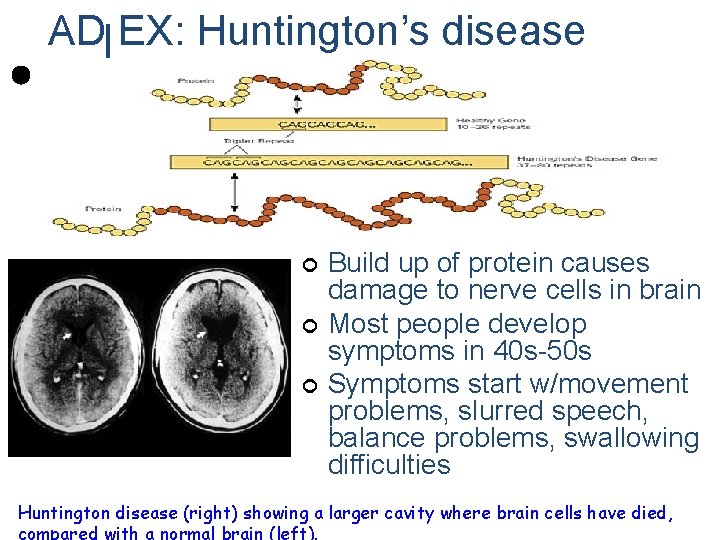 AD EX: Huntington’s disease ¢ ¢ ¢ Build up of protein causes damage to AD EX: Huntington’s disease ¢ ¢ ¢ Build up of protein causes damage to