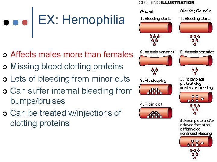EX: Hemophilia ¢ ¢ ¢ Affects males more than females Missing blood clotting proteins EX: Hemophilia ¢ ¢ ¢ Affects males more than females Missing blood clotting proteins