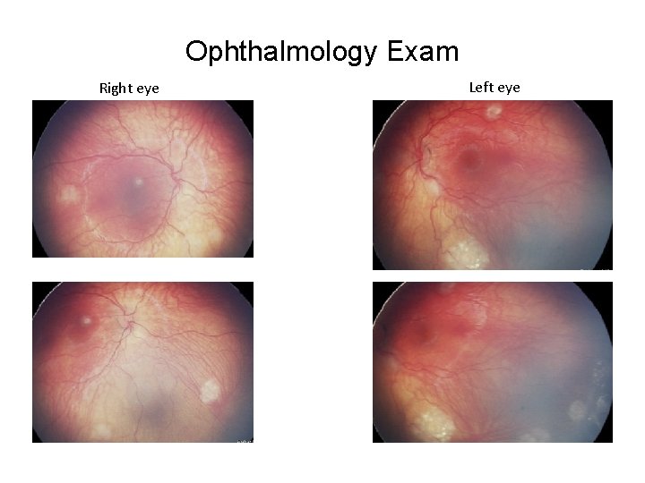 Ophthalmology Exam Right eye Left eye 