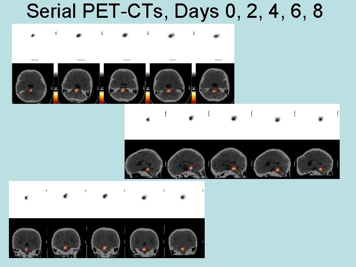 Serial PET-CTs, Days 0, 2, 4, 6, 8 
