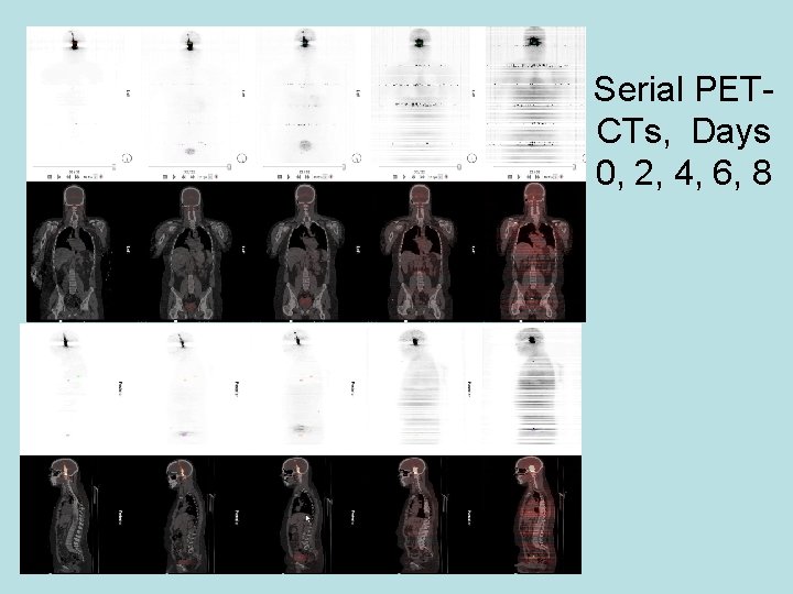 Serial PETCTs, Days 0, 2, 4, 6, 8 