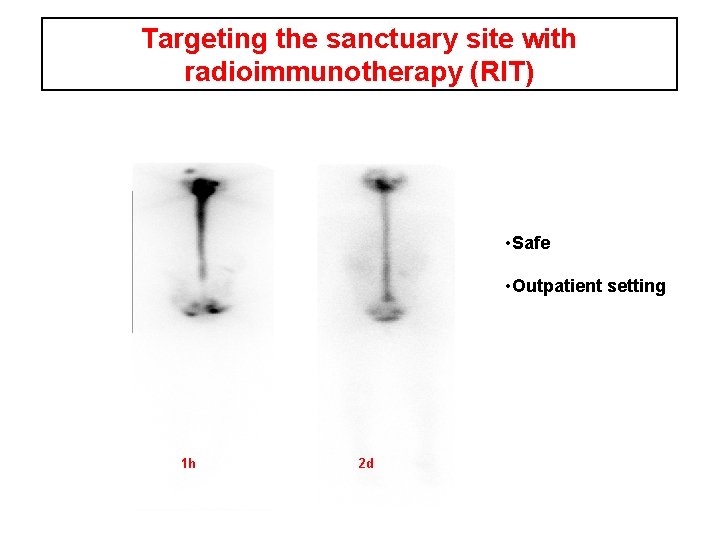Targeting the sanctuary site with radioimmunotherapy (RIT) • Safe • Outpatient setting 1 h