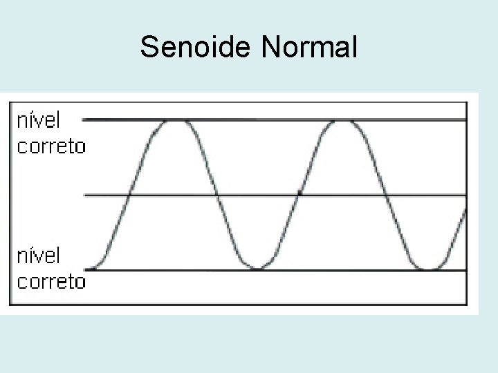 Senoide Normal 