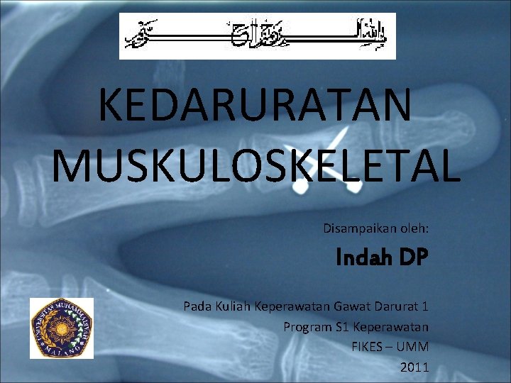 KEDARURATAN MUSKULOSKELETAL Disampaikan oleh: Indah DP Pada Kuliah Keperawatan Gawat Darurat 1 Program S