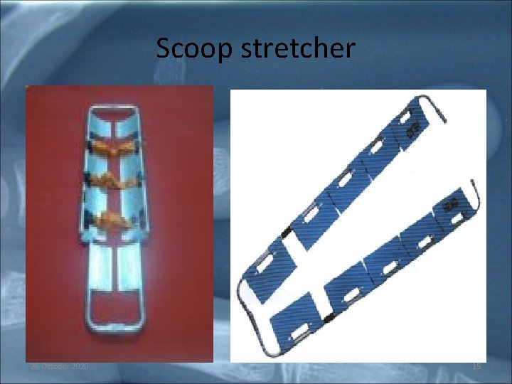 Scoop stretcher 26 October 2020 15 