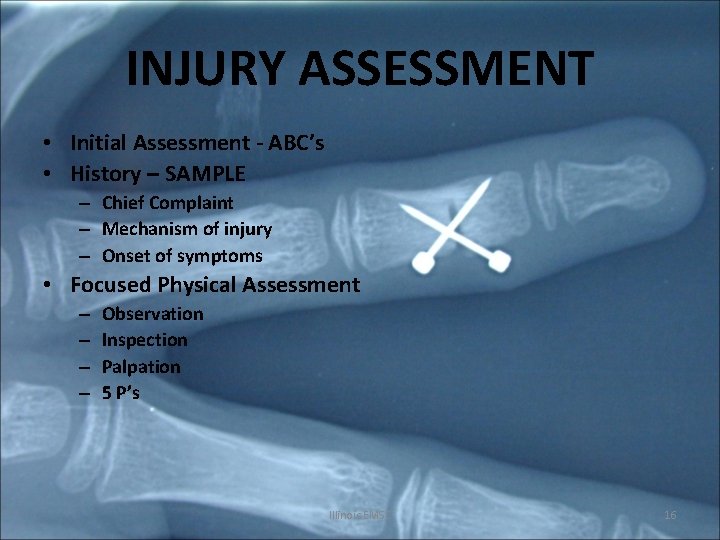 INJURY ASSESSMENT • Initial Assessment - ABC’s • History – SAMPLE – Chief Complaint