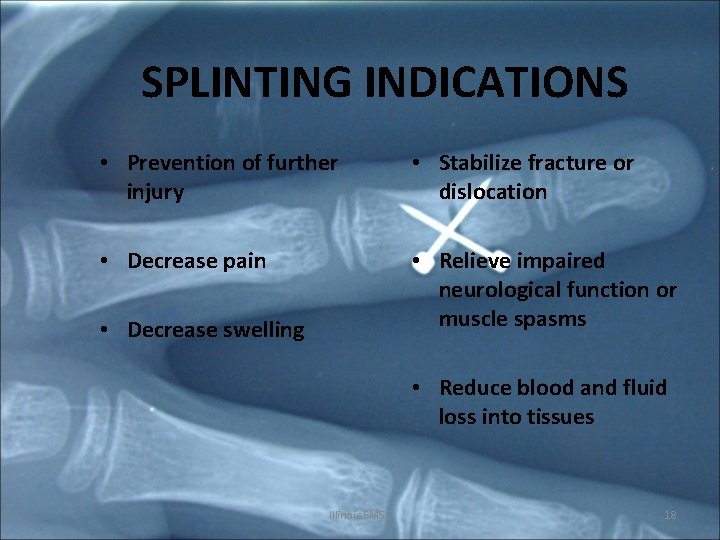 SPLINTING INDICATIONS • Prevention of further injury • Stabilize fracture or dislocation • Decrease