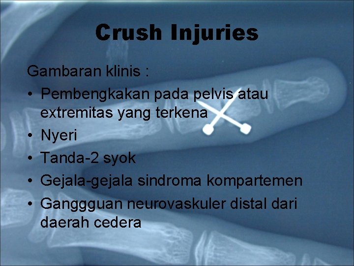 Crush Injuries Gambaran klinis : • Pembengkakan pada pelvis atau extremitas yang terkena •