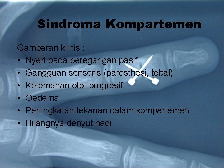 Sindroma Kompartemen Gambaran klinis : • Nyeri pada peregangan pasif • Gangguan sensoris (paresthesi,