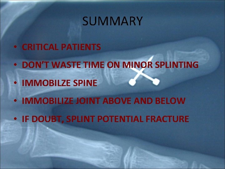 SUMMARY • CRITICAL PATIENTS • DON’T WASTE TIME ON MINOR SPLINTING • IMMOBILZE SPINE