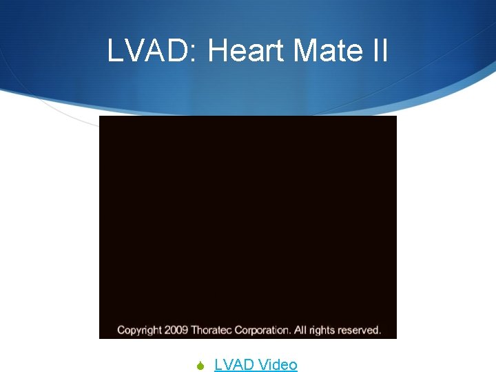 LVAD: Heart Mate II S LVAD Video 