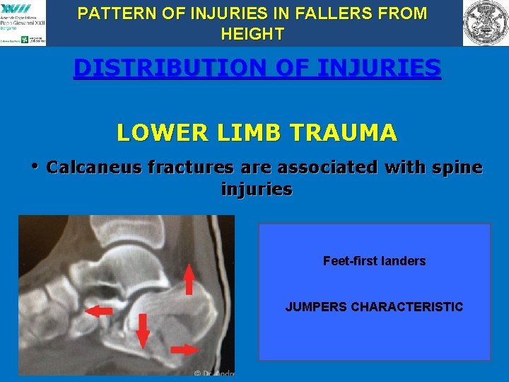PATTERN OF INJURIES IN FALLERS FROM HEIGHT DISTRIBUTION OF INJURIES LOWER LIMB TRAUMA •