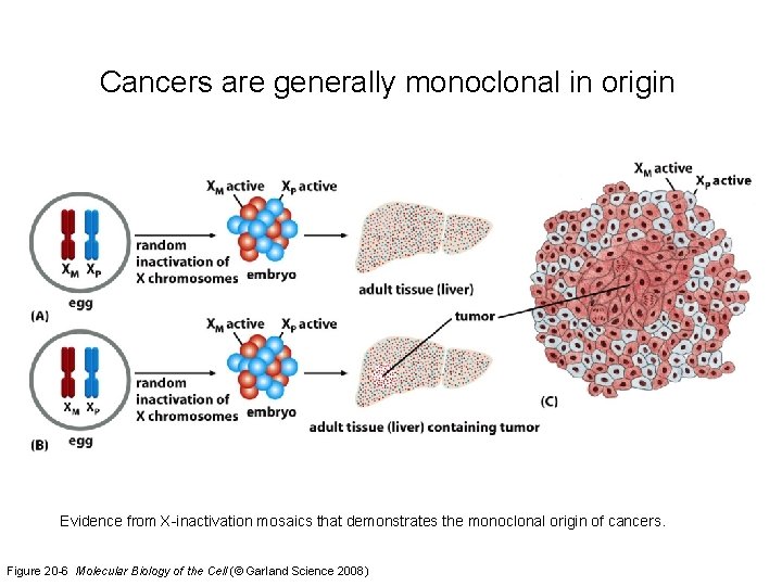 Cancers are generally monoclonal in origin Evidence from X-inactivation mosaics that demonstrates the monoclonal
