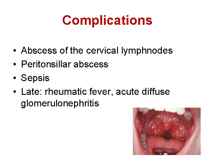 Complications • • Abscess of the cervical lymphnodes Peritonsillar abscess Sepsis Late: rheumatic fever,