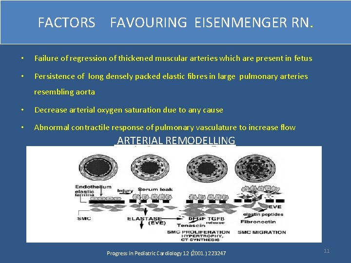 FACTORS FAVOURING EISENMENGER RN. • Failure of regression of thickened muscular arteries which are