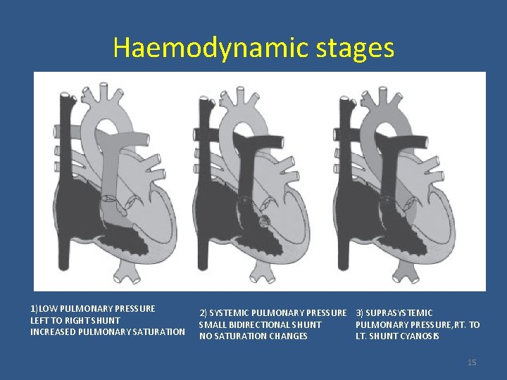 Haemodynamic stages 1)LOW PULMONARY PRESSURE LEFT TO RIGHT SHUNT INCREASED PULMONARY SATURATION 2) SYSTEMIC