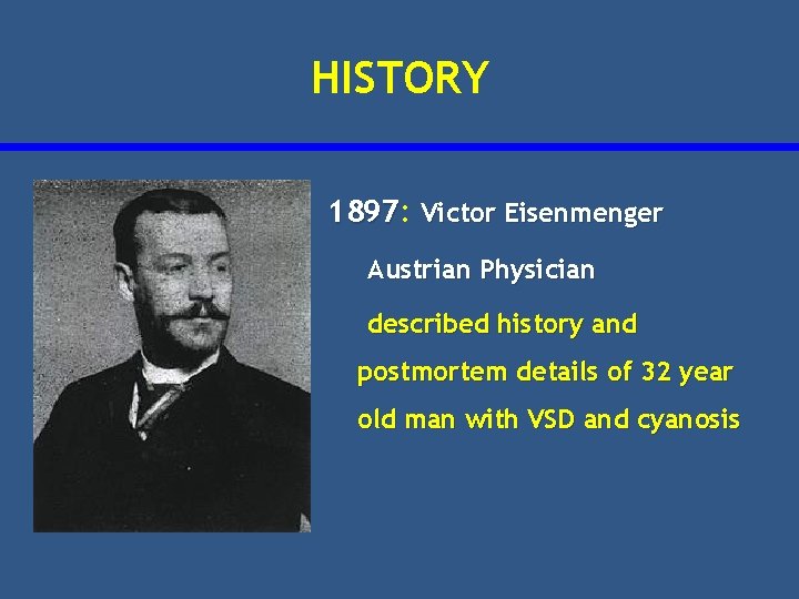 HISTORY 1897: 1897 Victor Eisenmenger Austrian Physician described history and postmortem details of 32