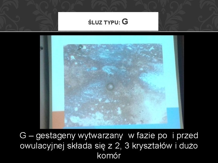 ŚLUZ TYPU: G G – gestageny wytwarzany w fazie po i przed owulacyjnej składa ŚLUZ TYPU: G G – gestageny wytwarzany w fazie po i przed owulacyjnej składa