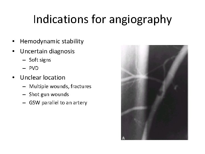 Indications for angiography • Hemodynamic stability • Uncertain diagnosis – Soft signs – PVD