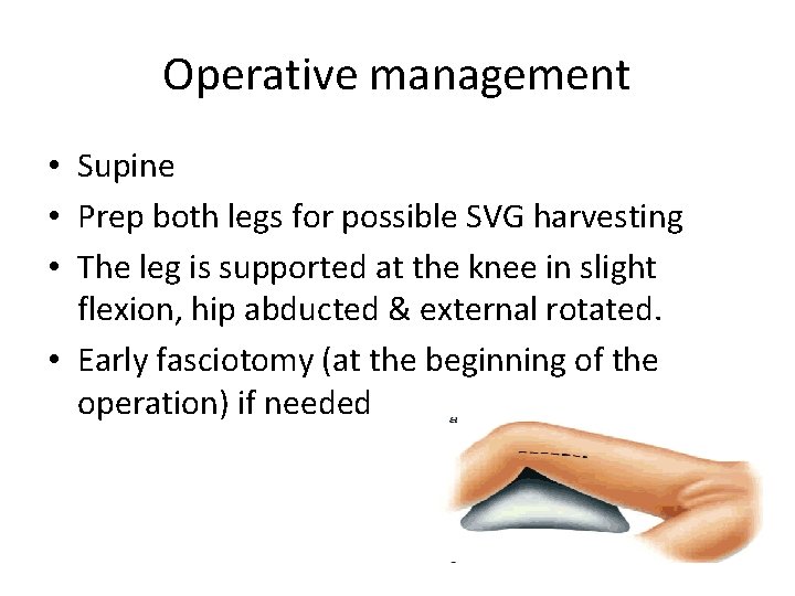 Operative management • Supine • Prep both legs for possible SVG harvesting • The