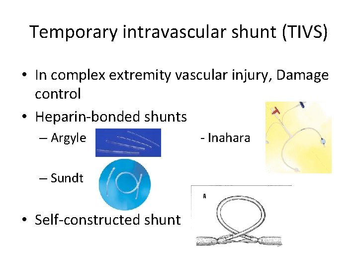 Temporary intravascular shunt (TIVS) • In complex extremity vascular injury, Damage control • Heparin-bonded