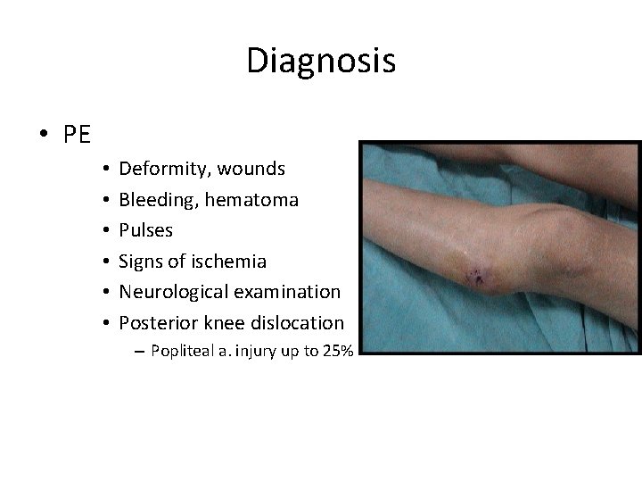Diagnosis • PE • • • Deformity, wounds Bleeding, hematoma Pulses Signs of ischemia