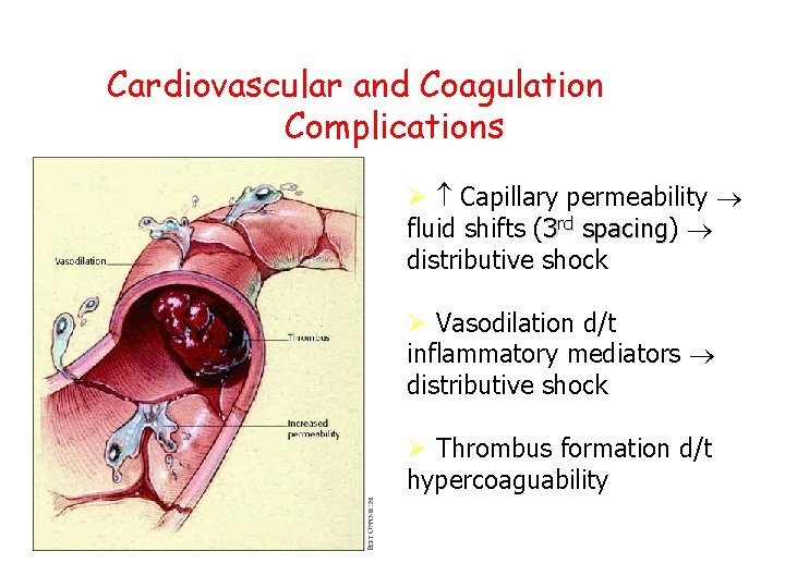 Cardiovascular and Coagulation Complications Capillary permeability fluid shifts (3 rd spacing) spacing distributive shock