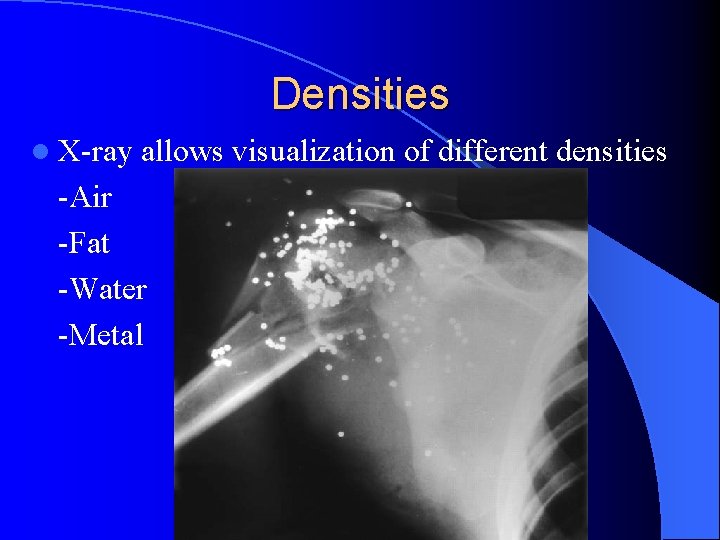 Densities l X-ray allows visualization of different densities -Air -Fat -Water -Metal 