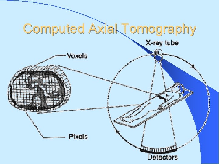 Computed Axial Tomography 