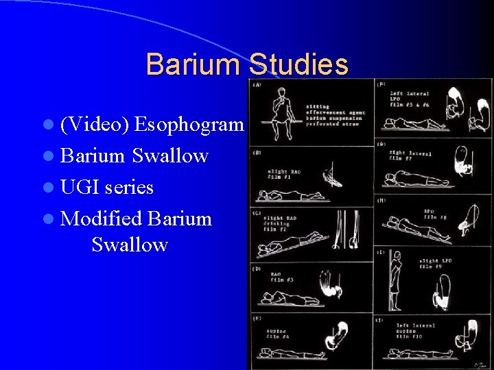 Barium Studies l (Video) Esophogram l Barium Swallow l UGI series l Modified Barium