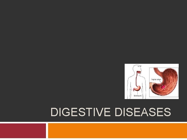 DIGESTIVE DISEASES 