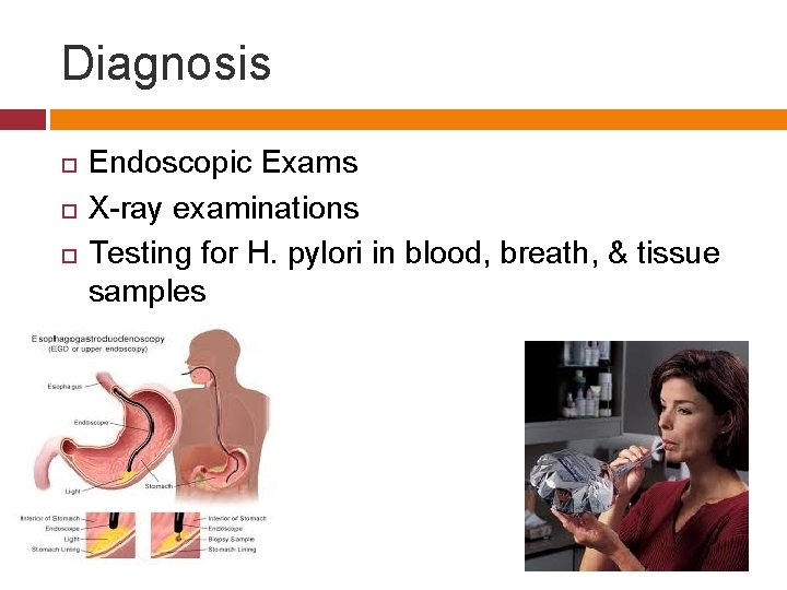 Diagnosis Endoscopic Exams X-ray examinations Testing for H. pylori in blood, breath, & tissue