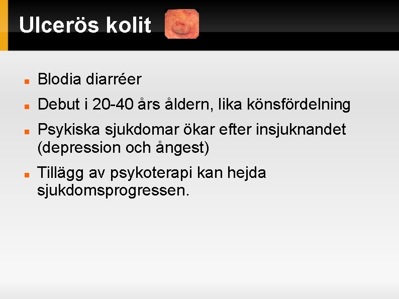 Ulcerös kolit Blodia diarréer Debut i 20 -40 års åldern, lika könsfördelning Psykiska sjukdomar Ulcerös kolit Blodia diarréer Debut i 20 -40 års åldern, lika könsfördelning Psykiska sjukdomar