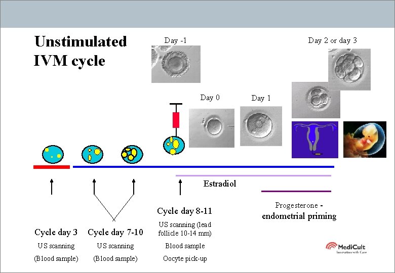 Unstimulated IVM cycle Day -1 Day 2 or day 3 Day 0 Day 1