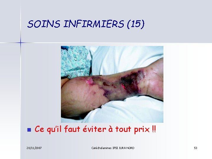 SOINS INFIRMIERS (15) n Ce qu’il faut éviter à tout prix !! 20/11/2007 Catécholamines