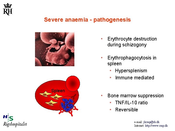 Severe anaemia - pathogenesis • Erythrocyte destruction during schizogony • Erythrophagocytosis in spleen •