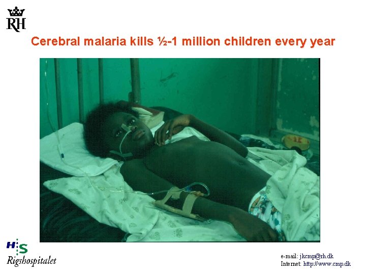 Cerebral malaria kills ½-1 million children every year e-mail: jkcmp@rh. dk Internet: http: //www.