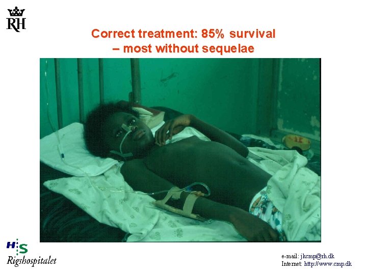 Correct treatment: 85% survival – most without sequelae e-mail: jkcmp@rh. dk Internet: http: //www.