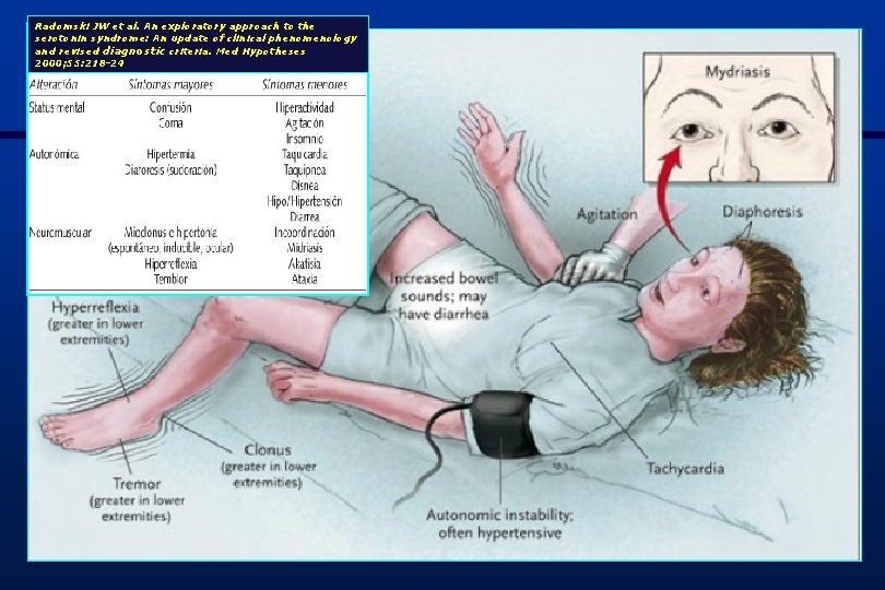 Radomski JW et al. An exploratory approach to the serotonin syndrome: An update of