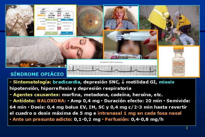 SÍNDROME OPIÁCEO - Sintomatología: bradicardia, depresión SNC, motilidad GI, miosis hipotensión, hiporreflexia y depresión