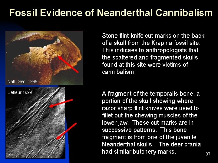Fossil Evidence of Neanderthal Cannibalism Stone flint knife cut marks on the back of Fossil Evidence of Neanderthal Cannibalism Stone flint knife cut marks on the back of